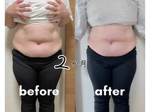 脂肪冷却×筋肉増強を２ヶ月間で♪運動や食事制限ナシ！！