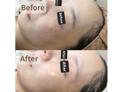 ダイアモンドリリー(DIAMONDLILY)の写真