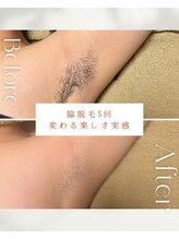 ビーエックス(.BX)/全身脱毛・ワキ脱毛・脇脱毛