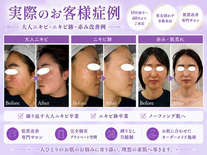 ノア 新宿(Noa)の写真