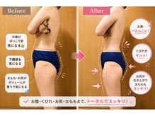 ヨサパーク タマ 千歳店(YOSA PARK Tama)の雰囲気（初回施術前後のボディライン比較 (※効果は個人差があります。)）