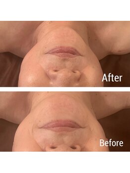 リサスミー(Lithas Me)/憎きたるみからの解放！！