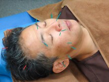 ナディ鍼灸治療院/美容鍼灸