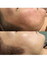 スペチアーレ 夙川/お肌本来の輝き