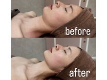 ナルシス(Narcissus)/インディバフェイシャル90分