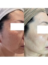 由縁/肌改善プログラム