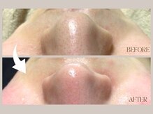 アフロディーテ(Aphrodite)