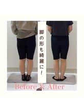 スタイルラボ高松/産後骨盤矯正の効果♪