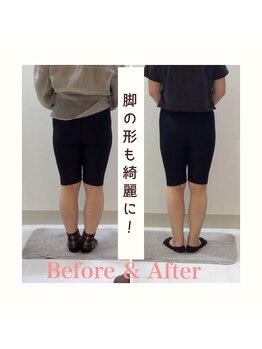 スタイルラボ高松/産後骨盤矯正の効果♪