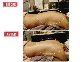 巡りラボ/ビフォーアフター４