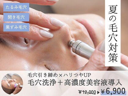 リベラ(Libera)の写真