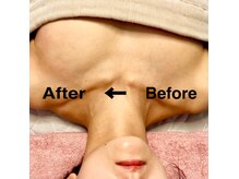 すなお 溝の口(Sunao)の雰囲気(1回でこの変化!一度育てば戻らない一生モノのバストアップ育乳)