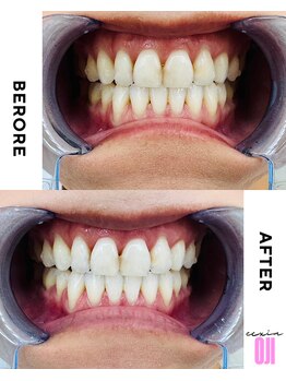 エクシアホワイトニング 王寺店/