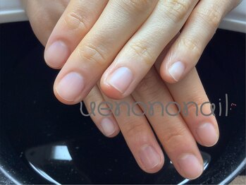 ウエノノネイル 上野(uenononail)の写真/巻き爪改善も◎幅広い悩みやご要望に対応できる技術力に自信。複雑なデザインも爪のコンプレックスも相談可