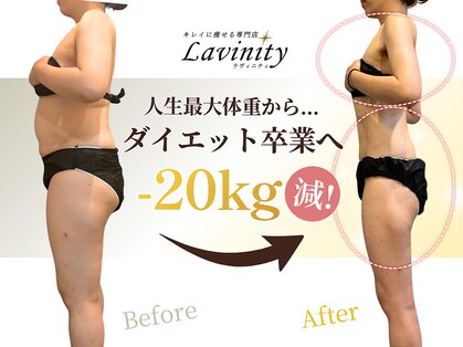 ラヴィニティ 南越谷店(Lavinity)の写真