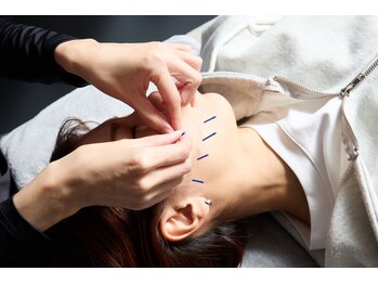 アロエベル(aloe Belle)の写真/骨格から美しい引き上がった憧れのフェイスラインへ★お顔のむくみを解消し、小顔効果◎