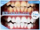 ホワイトニングショップ 豊橋店(WHITENING SHOP)の写真