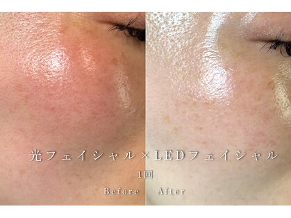 リリー(LILY.)の写真