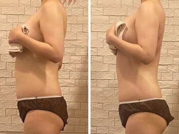 うつくし痩身 美サロン ゼットワン(Z-ONE)の写真/【疲労回復×痩身】身体の疲れ・肩こり・腰痛・むくみ改善♪筋膜リリースメディセル全身60分が2回で¥9800♪