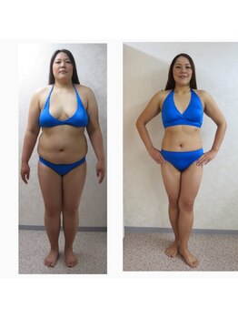 ビューティービューティー(beauty×beauty)/1ヶ月集中サイズダウンコース