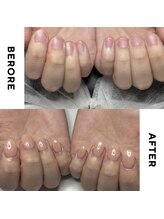 リミズネイルビューティー 名駅店(RimisNailxbeauty)/【美爪育成】深爪・噛み爪改善
