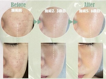 デュマージュ オブ サンシャインビューティー(DeuMarge of sunshinebeauty)