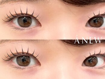 アニュー 目黒(ANEW)の写真/目黒駅徒歩3分の駅近好立地で通いやすさ◎自然に垢抜ける似合わせデザインと持続力にこだわった施術♪