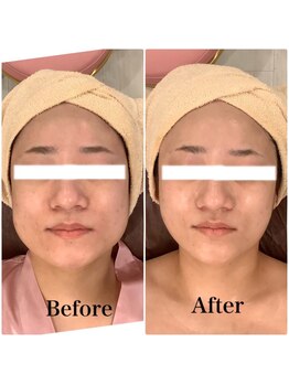 スペチアーレ 夙川/小顔で大変身