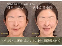 バンブー(bamboo)