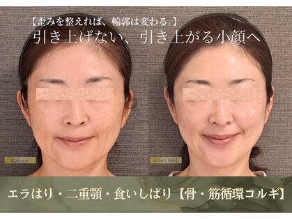 バンブー(bamboo)の写真