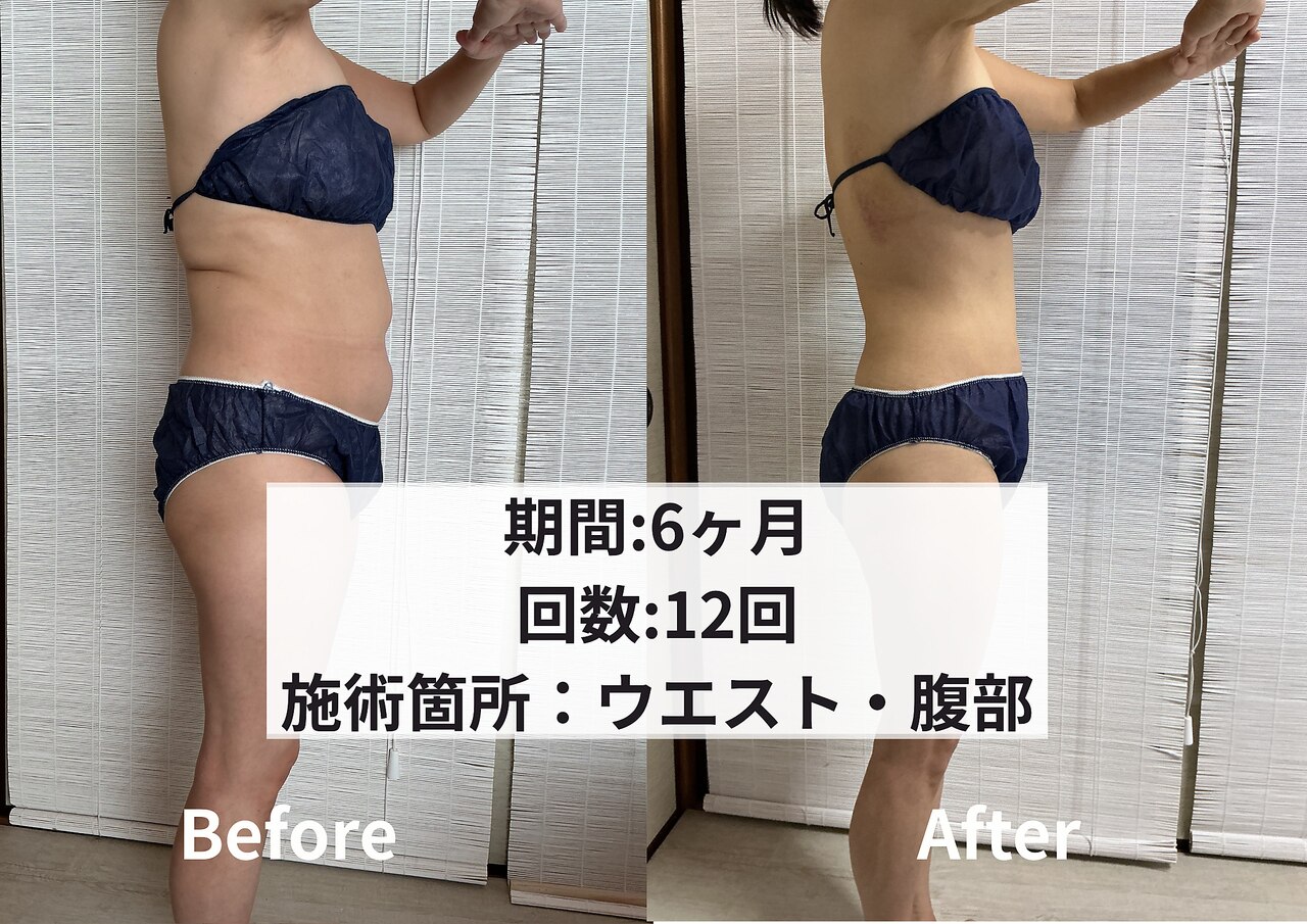 クライオ360 茅ケ崎(Cryo360)｜ホットペッパービューティー