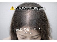 ウーム
