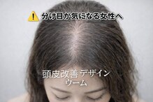 ウーム