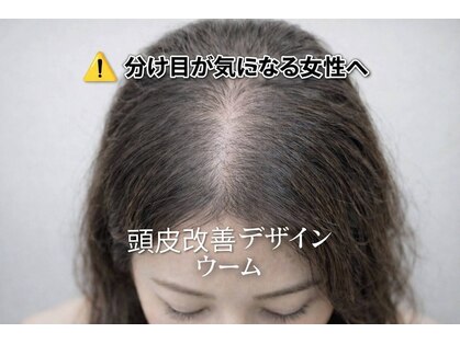 ウームの写真