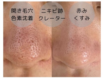アオラ(Aola)の写真