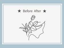 べセラ(BESERA)/Before After