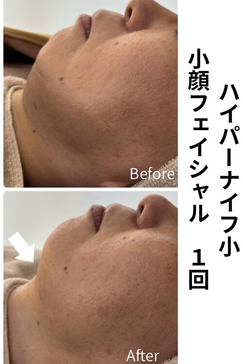 フォト｜タノソイネ(tanosoine)｜ホットペッパービューティー