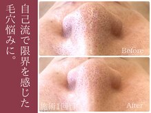 マシェリ 吉祥寺(Macherie)