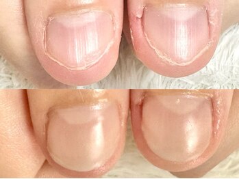 深爪矯正 爪悩み専門店 グラシナ 西宮北口店【4/3 NEW OPEN（予定）】/