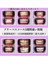 ルブラン 奈良店(Le Blanc)/白い歯っていいなって