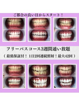 ルブラン 奈良店(Le Blanc)/白い歯っていいなって