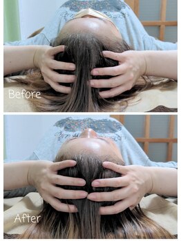 ラクシス(Luxis)/ドライヘッドスパ