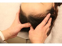 フー 橘通店(FUU)/頭痛や耳鳴りでお悩みの方に！