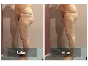 ビューティエン(beauty EN)/痩身ダイエットマッサージエステ