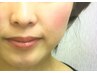 【小顔と肩こりが気になるお客様】お顔&お体のお試し¥1980小顔矯正でスッキリ