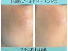 リメイククリニカルビューティー(Remake clinical beauty)/