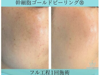 リメイククリニカルビューティー(Remake clinical beauty)/