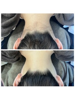 ミース 仙台長町店/うなじ●ビフォーアフター