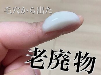 クルル(KROL)の写真/【最高峰の技術】老廃物の排出促進！みるみる変わるハリ艶に思わずうっとり♪自慢したくなる素肌へ★