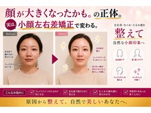 モアフェイス 池袋店(More Face)の雰囲気（今日、小顔になれるコース!）